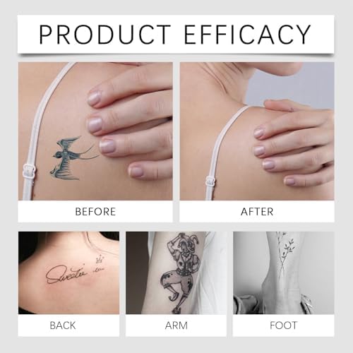 Tattoo Removal Cream - Safe & Painless Tattoo Dissolving Gel For Effective Tattoo Removal Gentle On Skin Moisturizes & Repairs 30g/1oz - Canadian Formula For Long-Lasting Results​