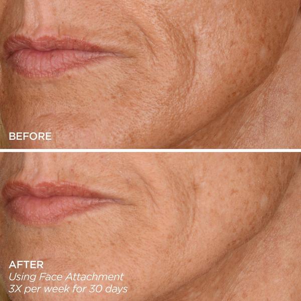 Ulta BeautyBio  Get That Glow GloPRO Facial Microneedling Discovery Set