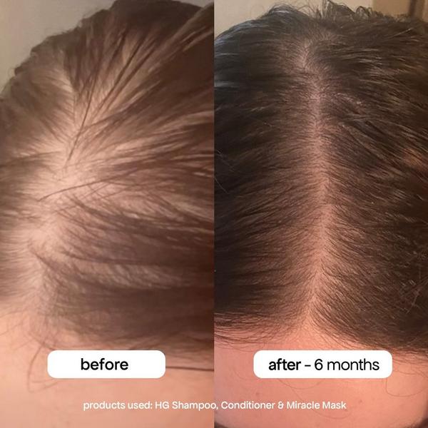 Ulta Bondi Boost  HG Miracle Hair Mask With Rosemary For Thinning Hair