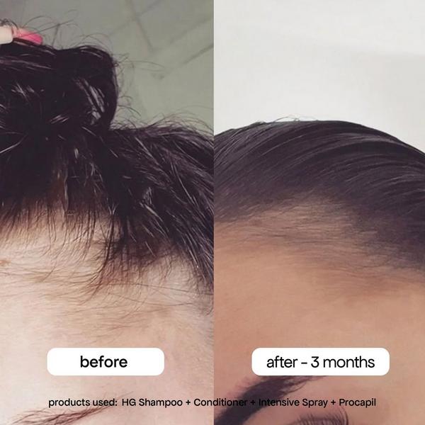 Ulta Bondi Boost  Intensive Spray Daily Scalp Serum For Thinning Hair With Rosemary