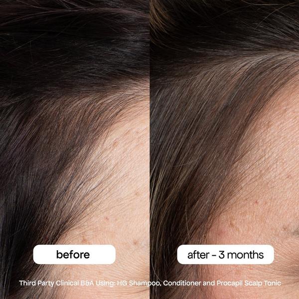 Ulta Bondi Boost  Procapil Hair Tonic Scalp Serum For Thinning Hair