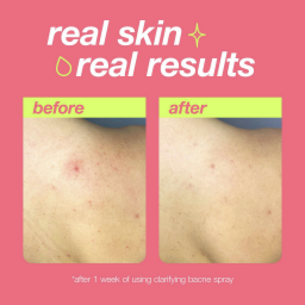 Ulta Dermalogica  Clear Start Clarifying Bacne Spray