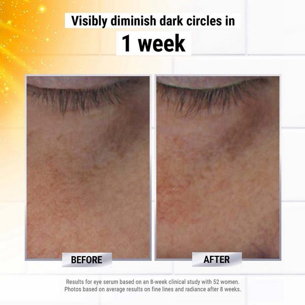 Ulta Kiehl's Since 1851  Powerful-Strength Dark Circle Reducing Vitamin C Eye Serum