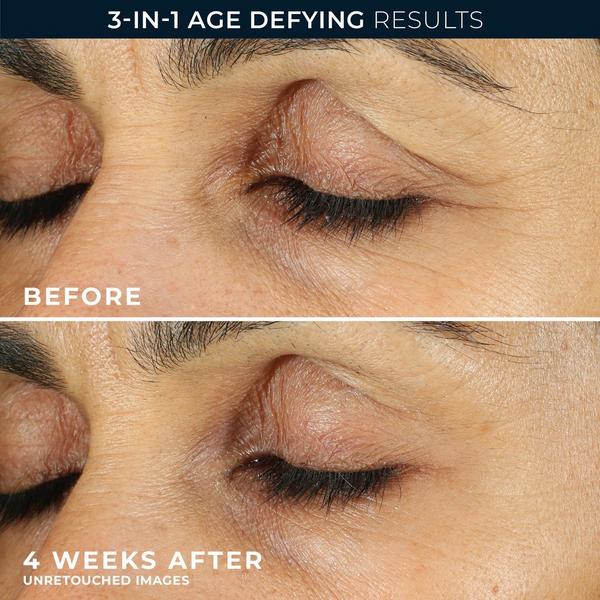 Ulta RoC  Retinol Line Smoothing Anti Wrinkle For Dark Circles Eye Cream