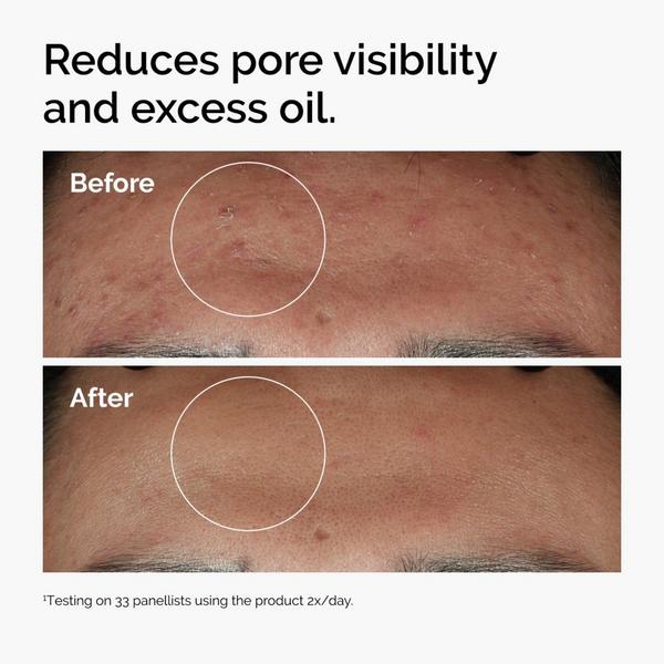 Ulta The Ordinary  Niacinamide 10% + Zinc 1% Serum For Oily Skin