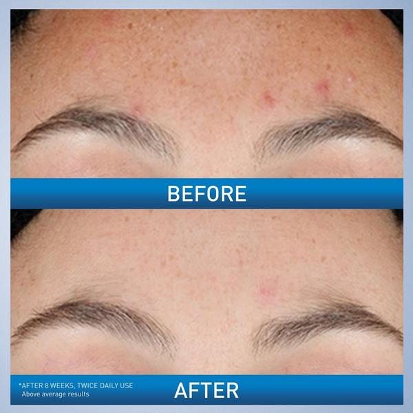 Ulta CeraVe  Resurfacing Retinol Serum
