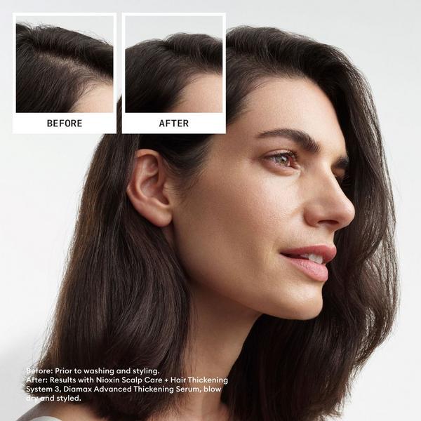 Ulta Nioxin  Scalp + Hair Thickening System 3 Kit