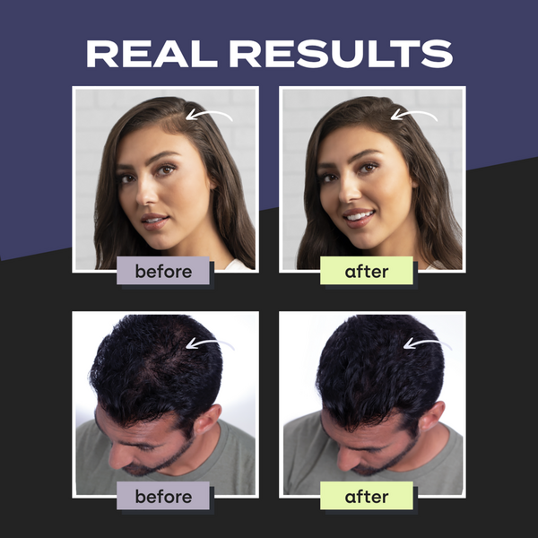 Ulta Toppik  Hair Building Fibers - Dark Brown