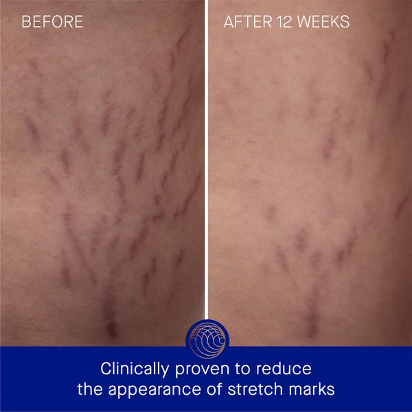 Augustinus Bader The Body Cream 200ml