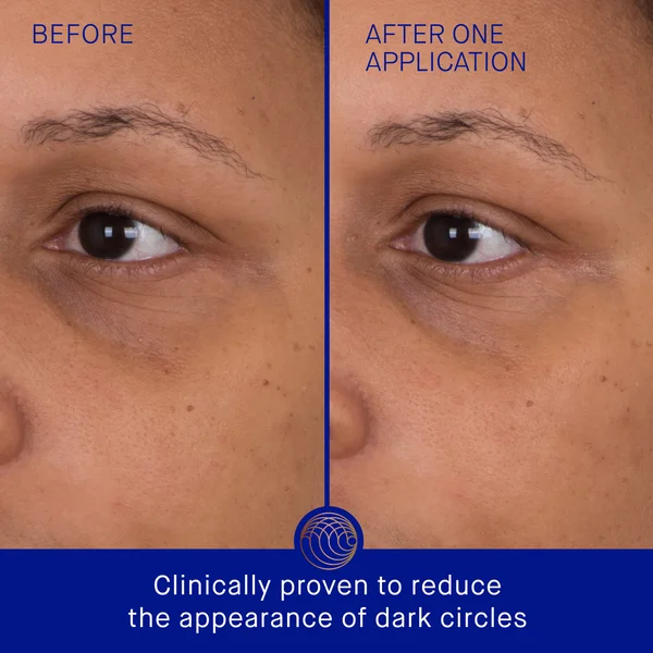 Augustinus Bader The Eye Patches Single Sachet