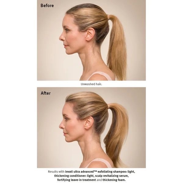 Aveda Invati Ultra Advanced Revitalizing Scalp Serum 150ml