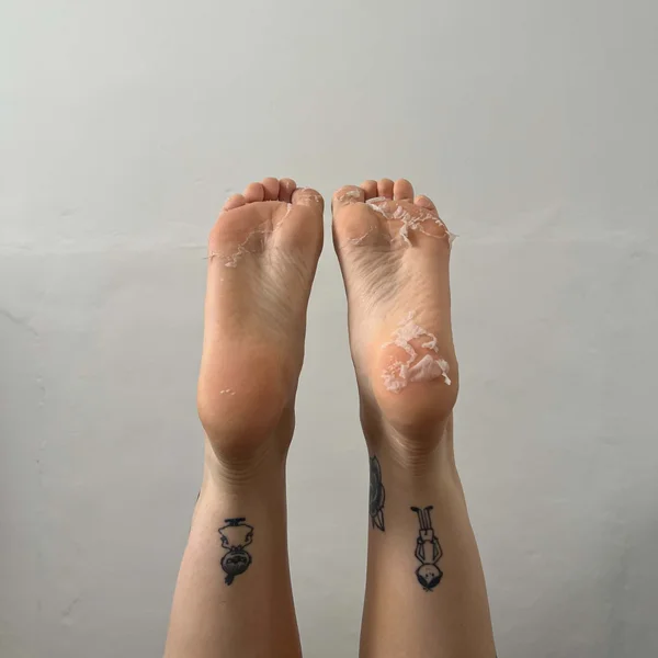 BEAUTYPRO Foot And Callus Peel With Over 17 Botanical And Fruit Extracts (1 Pair)