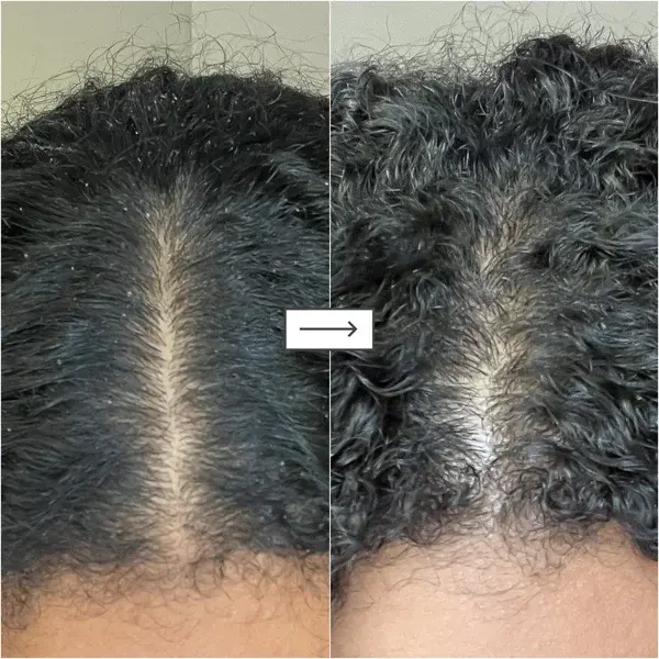 Briogeo Healthy Hair Delights Gift Set