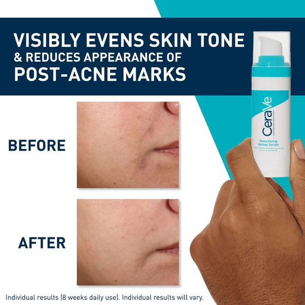 CeraVe Resurfacing Retinol Serum With Ceramides And Niacinamide For Blemish-Prone Skin 30ml