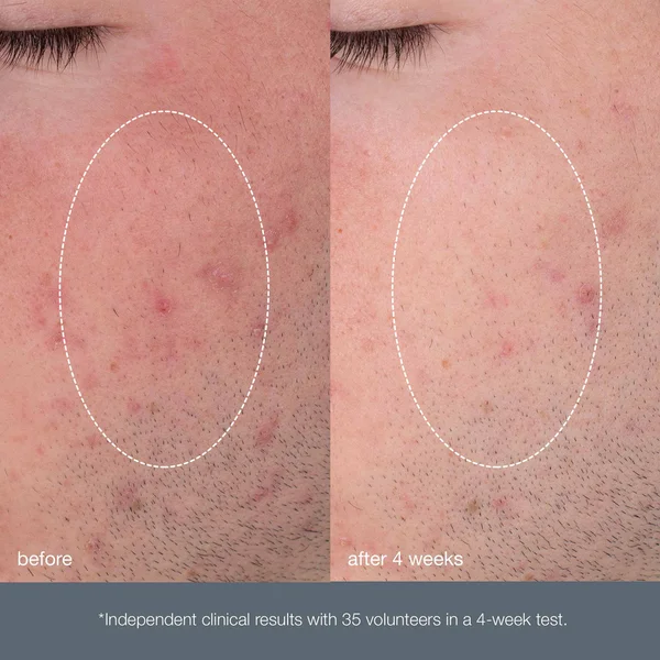 Dermalogica Daily Microfoliant 13g