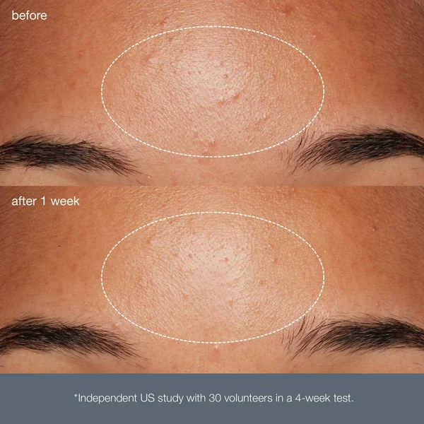 Dermalogica Daily Microfoliant 13g