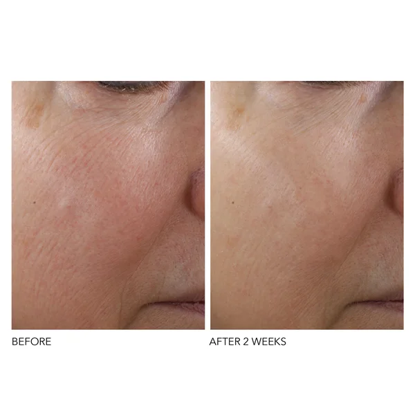 Dr. Dennis Gross Skincare Advanced Retinol And Ferulic Texture Renewal Serum