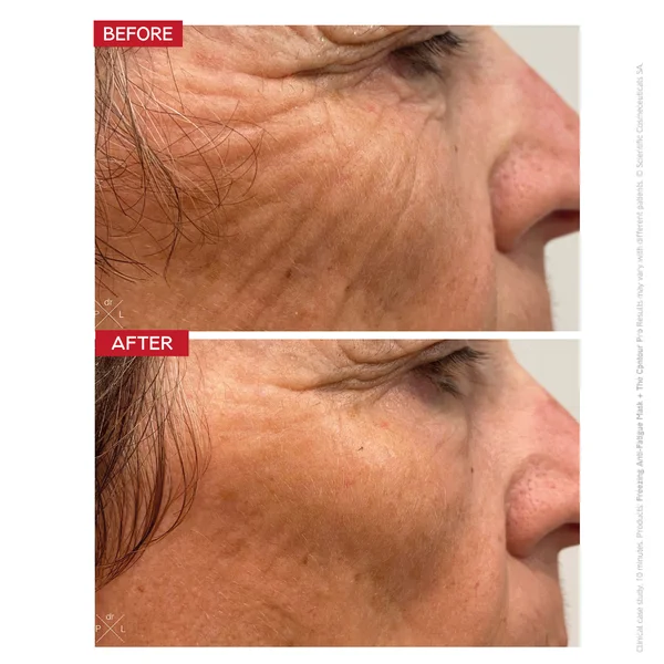 Dr. LEVY Switzerland The Contour Pro