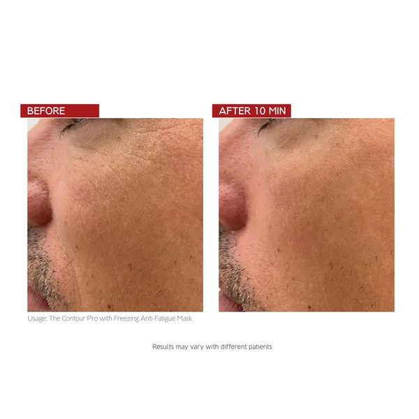 Dr. LEVY Switzerland The Contour Pro