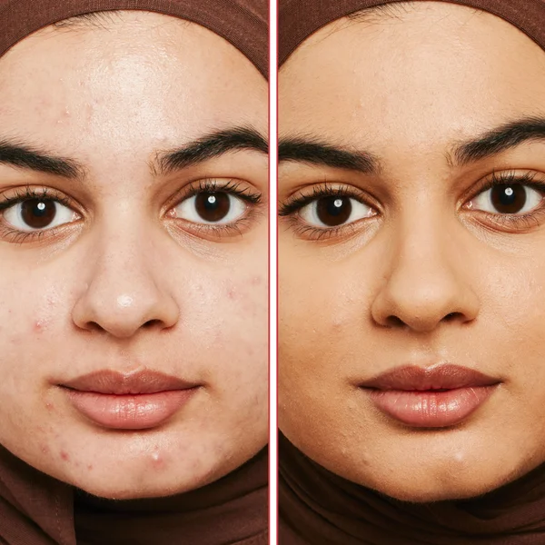 Erborian Super BB Concealer 10ml (Various Shades)