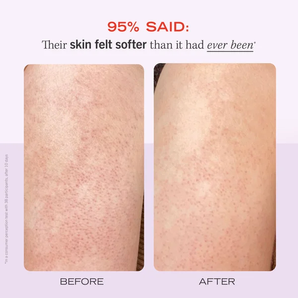 First Aid Beauty KP Bump Eraser Fresh Strawberry Body Scrub With 10% AHA 226g