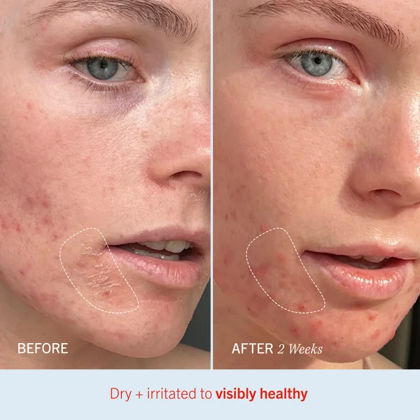 First Aid Beauty Ultra Repair Cream 226g