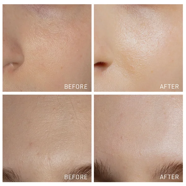 FOREO FAQ 202 LED Mask