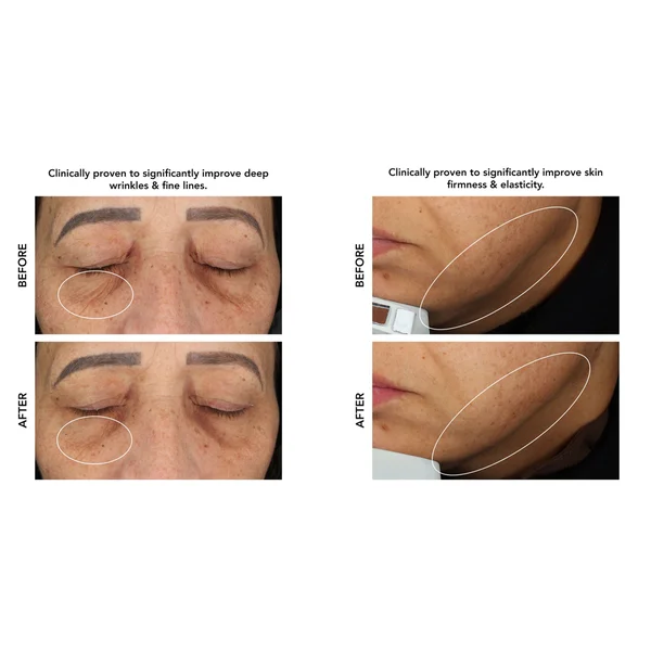 FOREO Supercharged Tone And Hydrate Set