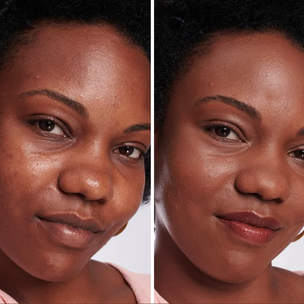 IT Cosmetics Bye Bye Dark Spot Concealer 33g (Various Shades)