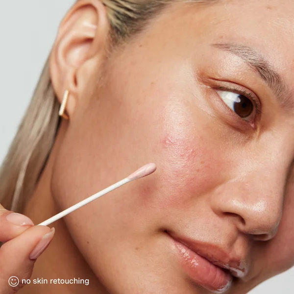 Kate Somerville Blemish Punisher Exclusive Kit