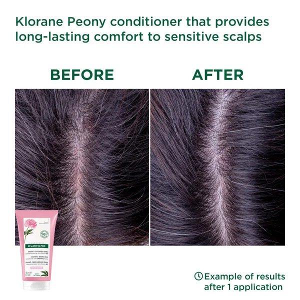 KLORANE Soothing Conditioner With Organic Peony For Dry Sensitive Scalps 150ml