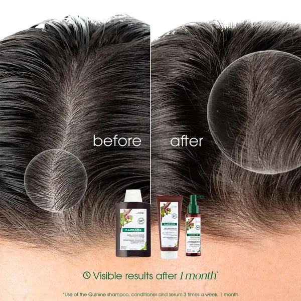 KLORANE Strengthening Shampoo With Quinine And Organic Edelweiss For Hair Thinning Loss 200ml