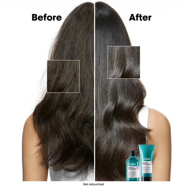 L’Oréal Professionnel Scalp Advanced Anti-Discomfort Shampoo 300ml And Refill Pack 500ml Deep Scalp Treatment