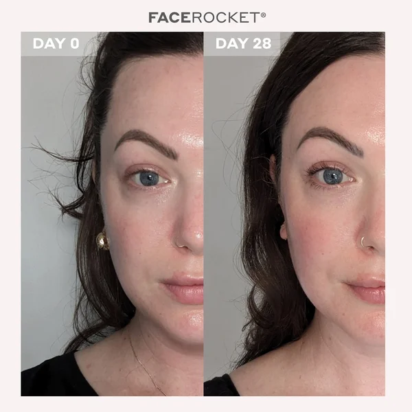 MAGNITONE FaceRocket 5-in-1 Facial Firming And Toning Device