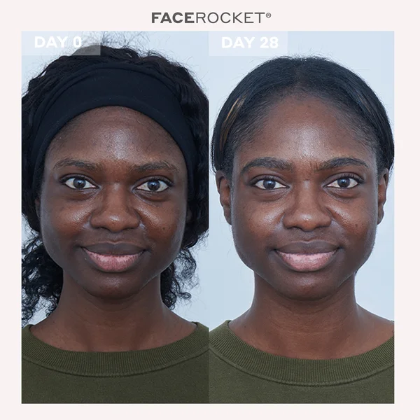 MAGNITONE FaceRocket 5-in-1 Facial Firming And Toning Device