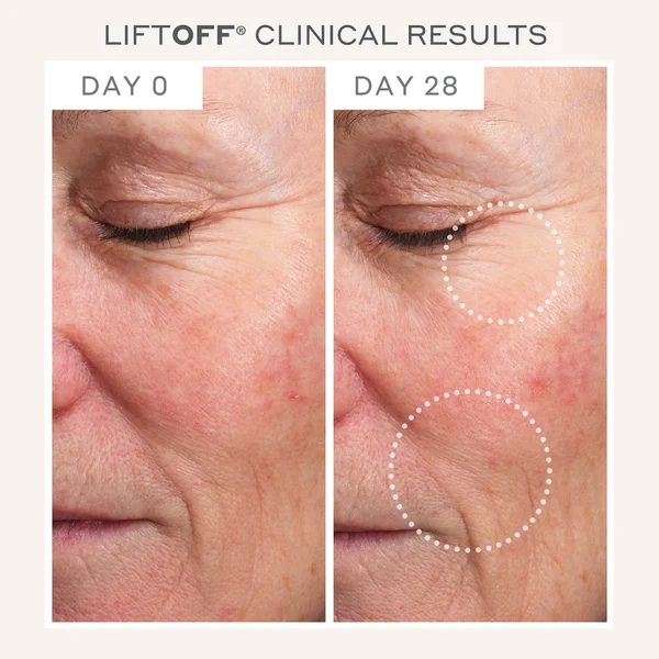 MAGNITONE LiftOff Microcurrent Facial Lifting And Toning Device - Grey