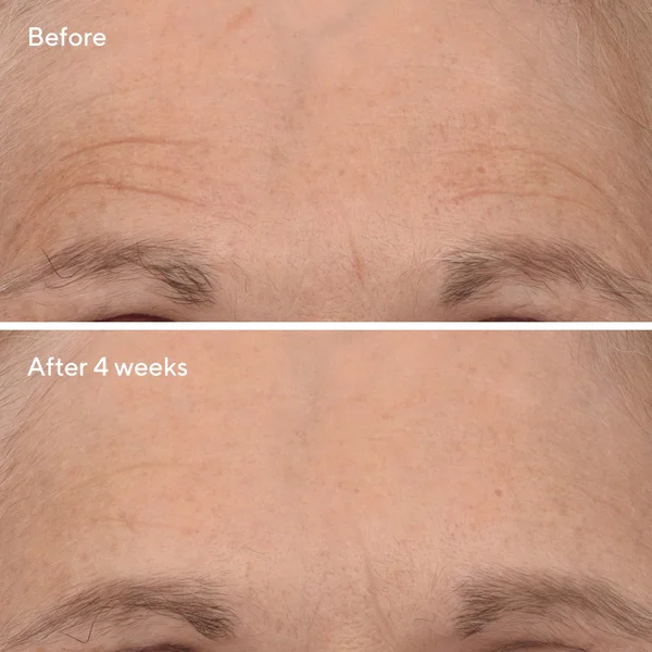 Murad Retinal ReSculpt Overnight Treatment Travel Size 15ml