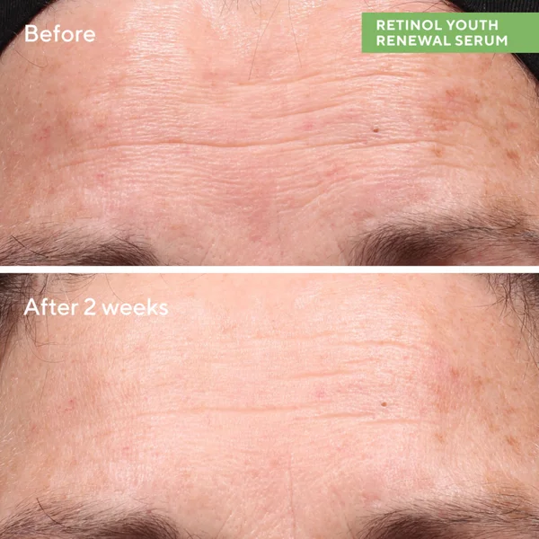 Murad Retinol Revival Set