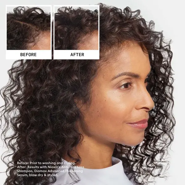 Nioxin Anti-Hair Loss Shampoo And Hair-Growth Serum Bundle