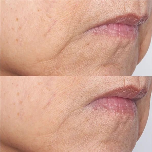 Perricone MD Cold Plasma Plus+ The Intensive Gel Mask 59ml