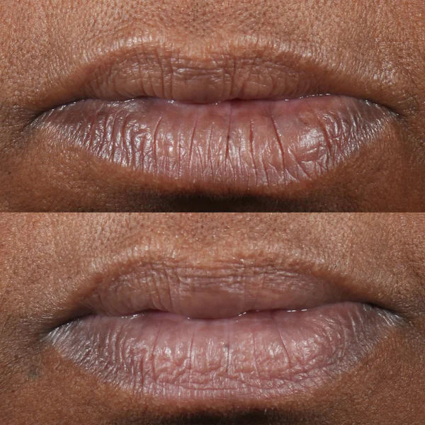 Perricone MD CP+ Lip Therapy 0.15 Oz FG