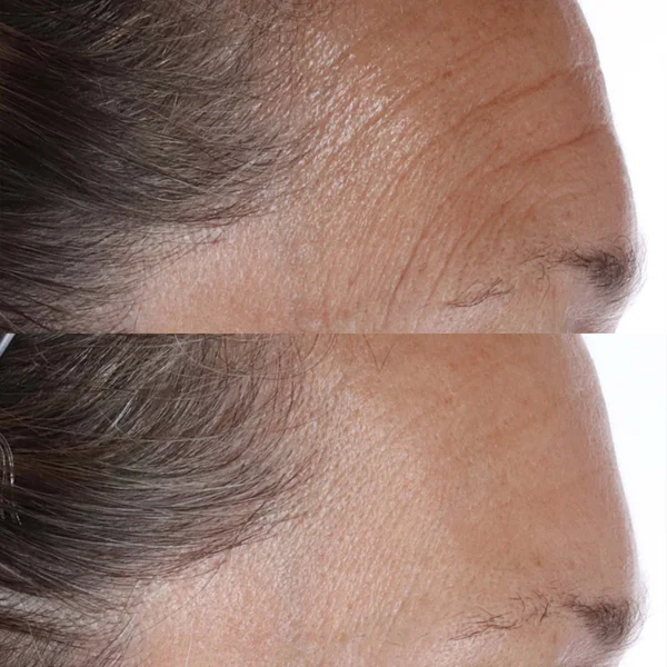 Perricone MD Essential Fx Acyl-Glutathione Chia Oil 30ml