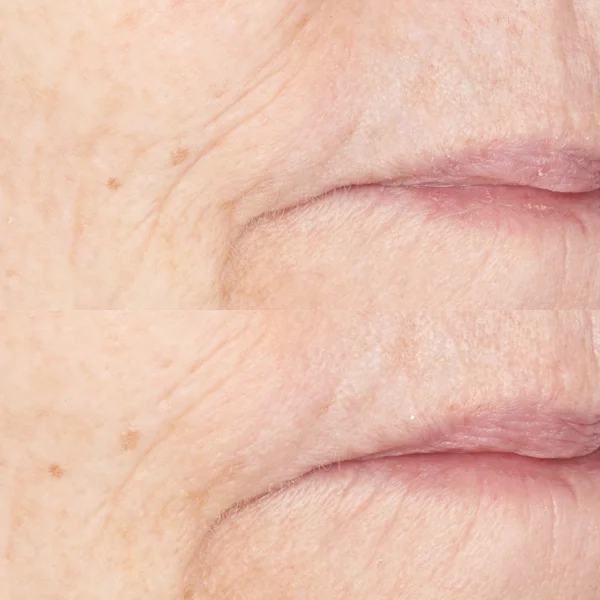 Perricone MD Neuropeptide Night Cream 74ml