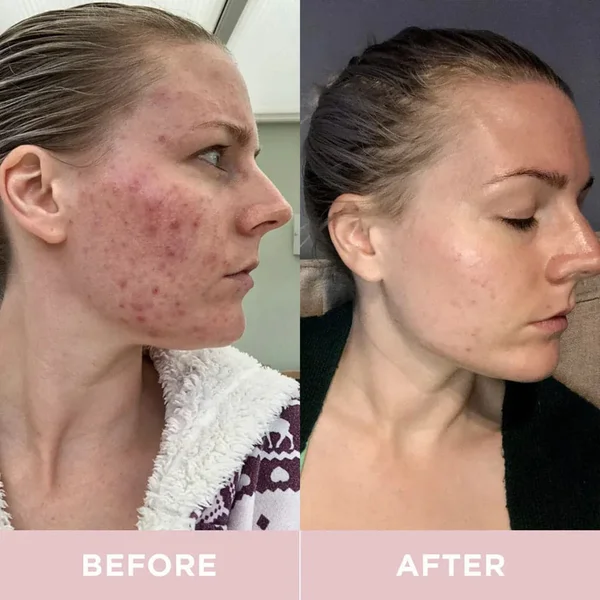 Revive Collagen Premium Liquid Hydrolysed Marine Collagen Drink - 28 Sachets