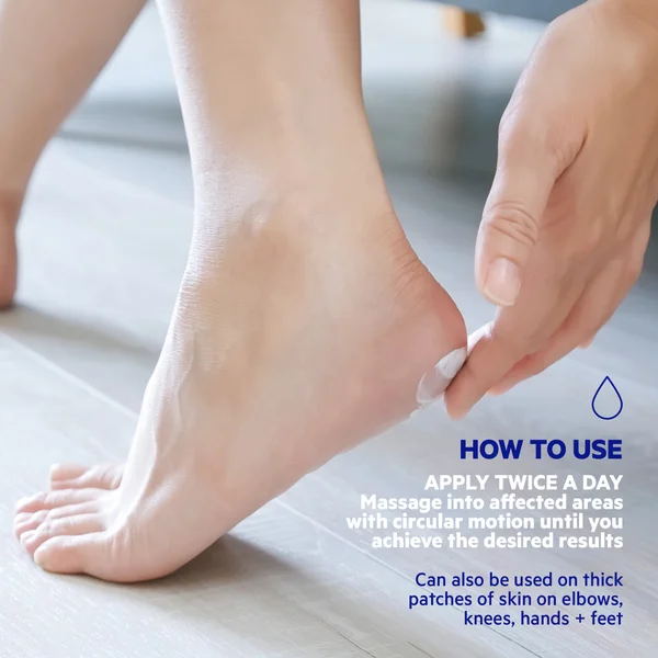 SVR XERIAL 50 Extreme -50% Pure Urea Foot Cream For Severly Dry Cracking Stubborn Hard Skin Prone To Corns And Calluses 50ml