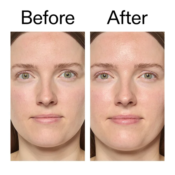 The INKEY List Exosome Hydro-Glow Complex 30ml