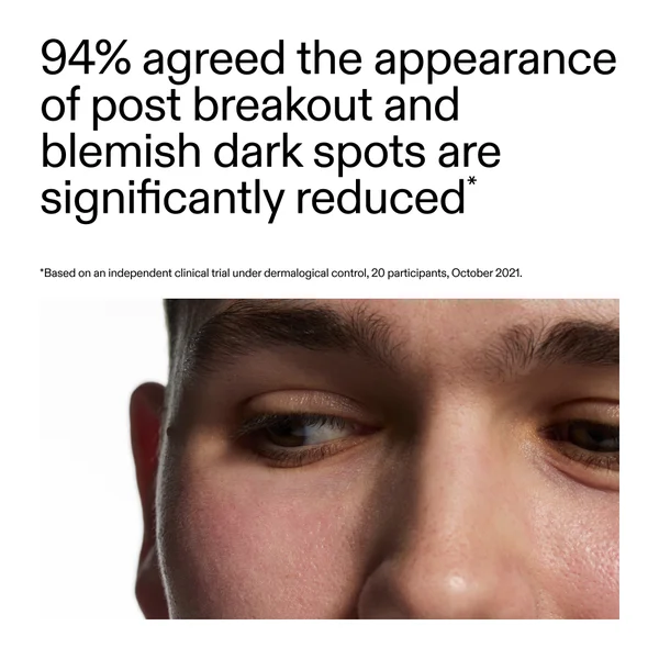 The INKEY List Mandelic Acid Treatment 15ml