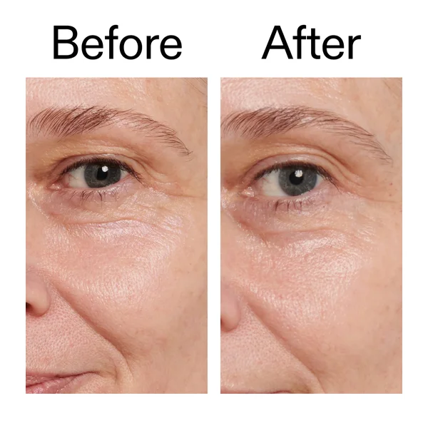 The INKEY List Retinol Eye Cream 15ml