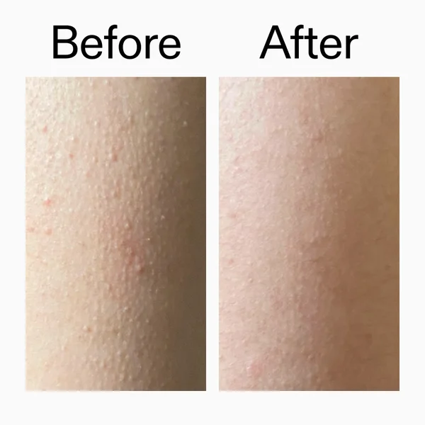 The INKEY List Smooth & Glow Body Duo