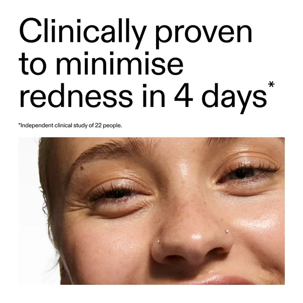 The INKEY List Super Solutions 10% Azelaic Acid Serum 30ml